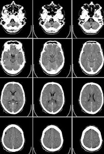 Brain Scans